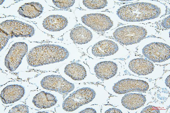 ALIX/PDCD6IP Mouse Monoclonal Antibody
