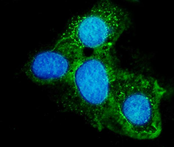 ABCG8 Rabbit Polyclonal Antibody