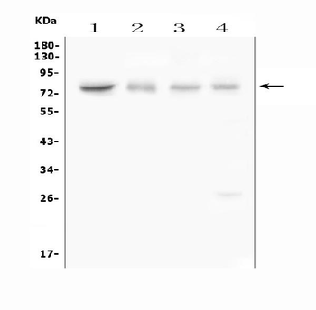 ABCG8 Rabbit Polyclonal Antibody