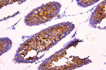 Acetyl Coenzyme A Carboxylase/ACACB Rabbit Polyclonal Antibody