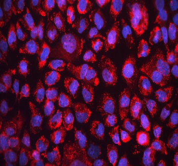FACL4/ACSL4 Rabbit Polyclonal Antibody