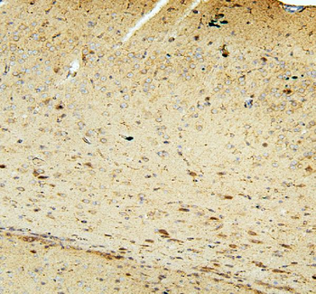 FACL4/ACSL4 Rabbit Polyclonal Antibody
