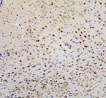 FACL4/ACSL4 Rabbit Polyclonal Antibody