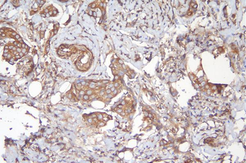APPL/APPL1 Rabbit Polyclonal Antibody