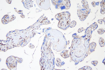 APPL/APPL1 Rabbit Polyclonal Antibody