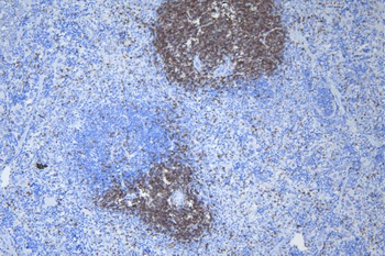 CD3 epsilon/Cd3e Rabbit Polyclonal Antibody