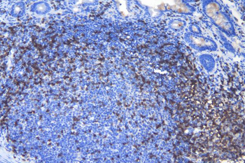 CD3 epsilon/Cd3e Rabbit Polyclonal Antibody