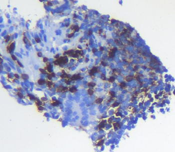 CD5 Rabbit Polyclonal Antibody