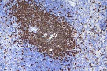 CD5 Rabbit Polyclonal Antibody