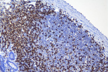 CD5 Rabbit Polyclonal Antibody