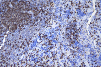 CD5 Rabbit Polyclonal Antibody
