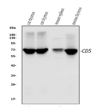 CD5 Rabbit Polyclonal Antibody
