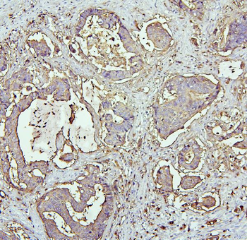 CEACAM5 Rabbit Polyclonal Antibody