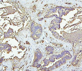 CEACAM5 Rabbit Polyclonal Antibody