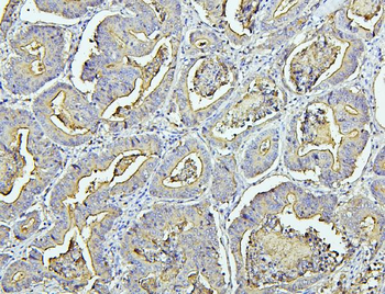 CEACAM5 Rabbit Polyclonal Antibody