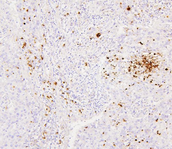CEACAM5 Rabbit Polyclonal Antibody
