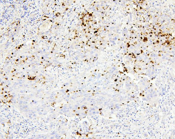 CEACAM5 Rabbit Polyclonal Antibody