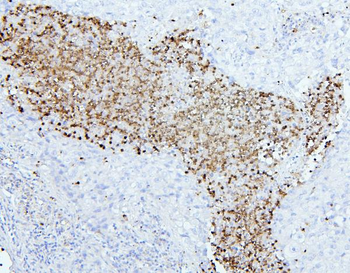 CEACAM5 Rabbit Polyclonal Antibody