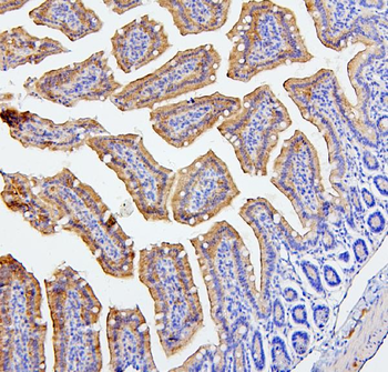 CEACAM5 Rabbit Polyclonal Antibody