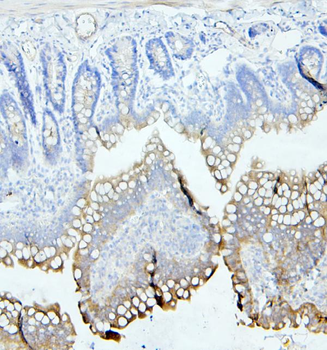 CEACAM5 Rabbit Polyclonal Antibody