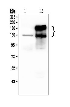 CEACAM5 Rabbit Polyclonal Antibody