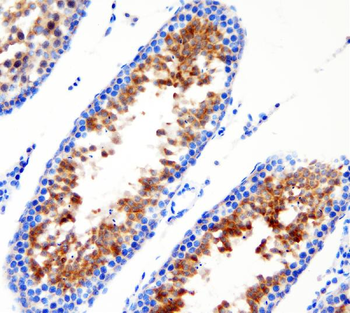 DDX1 Rabbit Polyclonal Antibody