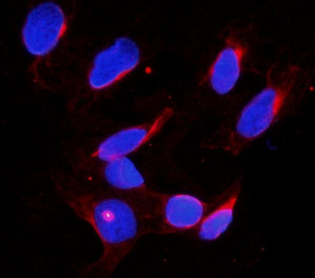 DDX4/MVH Rabbit Polyclonal Antibody