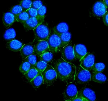 Desmoglein 2/DSG2 Rabbit Polyclonal Antibody