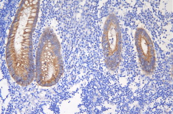 Desmoglein 2/DSG2 Rabbit Polyclonal Antibody