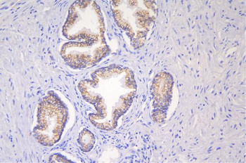 Desmoglein 2/DSG2 Rabbit Polyclonal Antibody