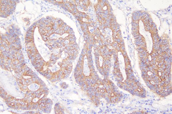 Desmoglein 2/DSG2 Rabbit Polyclonal Antibody