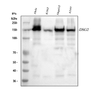 Desmoglein 2/DSG2 Rabbit Polyclonal Antibody