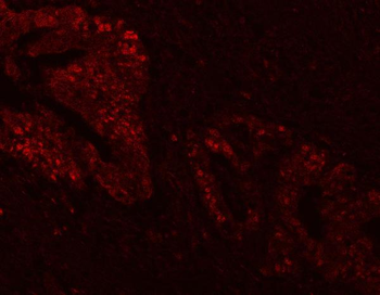 FEN1 Rabbit Polyclonal Antibody