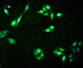 FHL FHL1 Rabbit Polyclonal Antibody