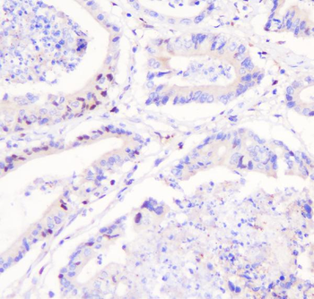 FHL FHL1 Rabbit Polyclonal Antibody