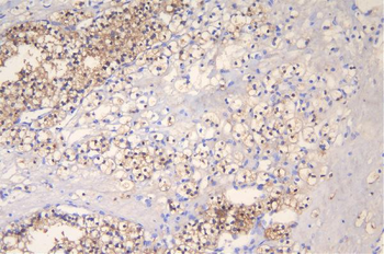 FHL FHL1 Rabbit Polyclonal Antibody