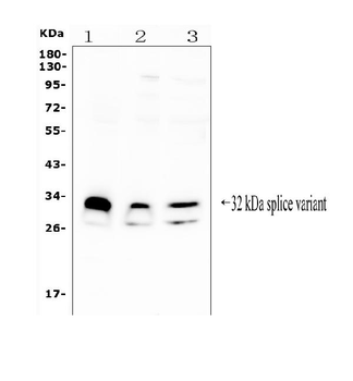 FHL FHL1 Rabbit Polyclonal Antibody