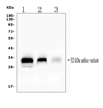 FHL Fhl1 Rabbit Polyclonal Antibody