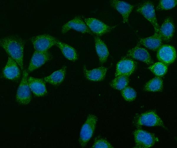 GLB1/Beta-galactosidase Rabbit Polyclonal Antibody
