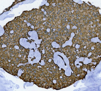 GLB1/Beta-galactosidase Rabbit Polyclonal Antibody
