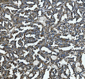 GLB1/Beta-galactosidase Rabbit Polyclonal Antibody