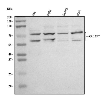 GLB1/Beta-galactosidase Rabbit Polyclonal Antibody