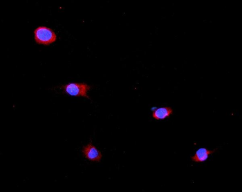 GLB1/Beta-galactosidase Rabbit Polyclonal Antibody