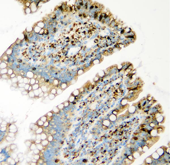 GLB1/Beta-galactosidase Rabbit Polyclonal Antibody
