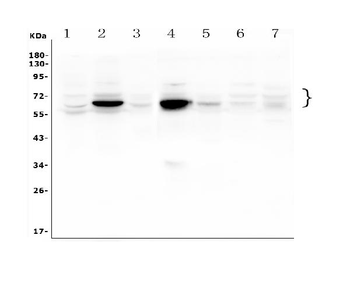 GLB1/Beta-galactosidase Rabbit Polyclonal Antibody