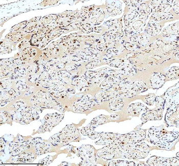 Histone H3 HIST1H3A/B/C/D/E/F/G/H/I/J Rabbit Polyclonal Antibody