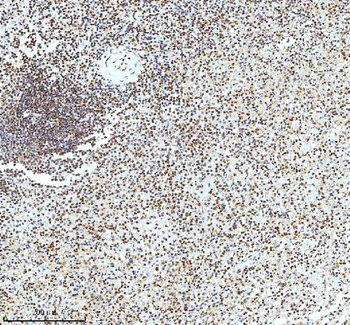 Histone H3 HIST1H3A/B/C/D/E/F/G/H/I/J Rabbit Polyclonal Antibody