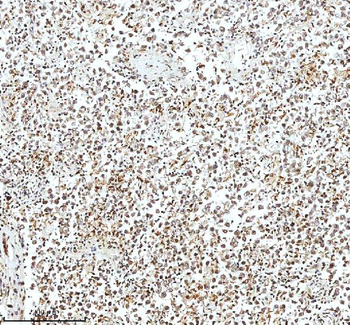 Histone H3 HIST1H3A/B/C/D/E/F/G/H/I/J Rabbit Polyclonal Antibody