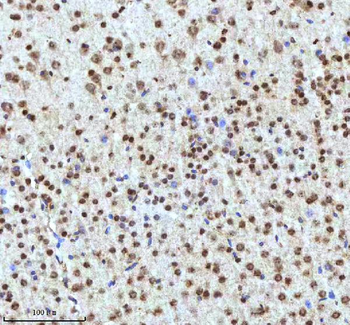 Histone H3 HIST1H3A/B/C/D/E/F/G/H/I/J Rabbit Polyclonal Antibody