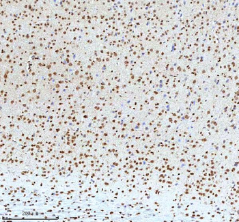 Histone H3 HIST1H3A/B/C/D/E/F/G/H/I/J Rabbit Polyclonal Antibody